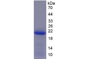SDS-PAGE analysis of Human ADAM15 Protein. (A Disintegrin and Metalloprotease 15 Protein)