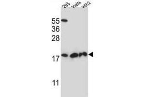 Western Blotting (WB) image for anti-Dihydrofolate Reductase-Like 1 (DHFRL1) antibody (ABIN2997304) (DHFRL1 antibody)