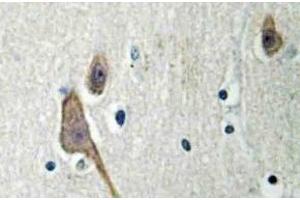 Immunohistochemistry (IHC) analyzes of 14-3-3 zeta antibody in paraffin-embedded human brain tissue. (14-3-3 zeta antibody)