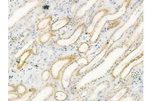 ABIN6258955 and ABIN6275155 at 1/100 staining human normal kidney tissue by IHC-P. (GSTT1 antibody  (N-Term))