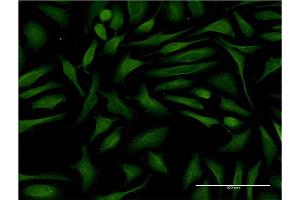 Immunofluorescence (IF) image for anti-Junction Mediating and Regulatory Protein, P53 Cofactor (JMY) (AA 535-634) antibody (ABIN530706)