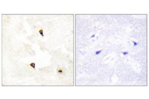 Immunohistochemistry (IHC) image for anti-Tumor Protein P53 Inducible Protein 11 (TP53I11) (Internal Region) antibody (ABIN1848934) (TP53I11 antibody  (Internal Region))