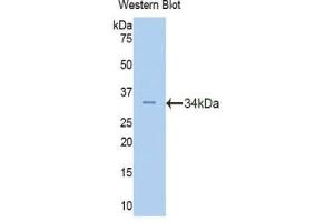 Western blot analysis of the recombinant protein. (Fascin 2 antibody  (AA 8-278))
