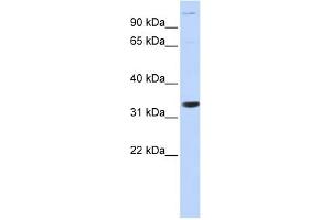 WB Suggested Anti-ANP32B Antibody Titration: 0.