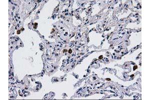 Immunohistochemical staining of paraffin-embedded Human lung tissue using anti-CCM2 mouse monoclonal antibody.