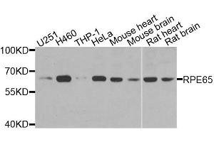 Western blot analysis of extracts of various cell lines, using RPE65 antibody (ABIN6003573) at 1/1000 dilution.