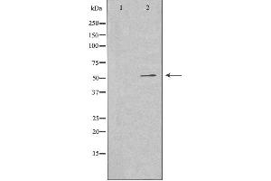 Western blot analysis of extracts from A549 cells using G3BP2 antibody.