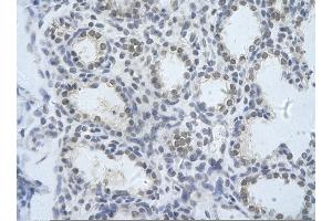 Rabbit Anti-KIAA0020 Antibody       Paraffin Embedded Tissue:  Human alveolar cell   Cellular Data:  Epithelial cells of renal tubule  Antibody Concentration:   4. (KIAA0020 antibody  (N-Term))