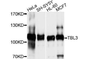 Western blot analysis of extracts of various cells, using TBL3 antibody.