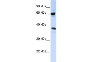 WB Suggested Anti-C6orf134 Antibody Titration:  0. (Chromosome 6 Open Reading Frame 134 (C6orf134) (Middle Region) antibody)