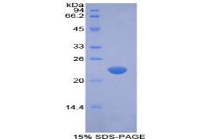 SDS-PAGE analysis of Rabbit Interferon beta Protein. (IFNB1 Protein)