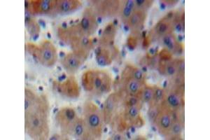 Used in DAB staining on fromalin fixed paraffin-embedded Liver tissue (SERPINB2 antibody  (AA 68-313))