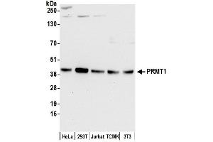 Western Blotting (WB) image for anti-Protein Arginine Methyltransferase 1 (PRMT1) (AA 1-50) antibody (ABIN7453933)