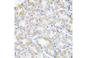 ANKRD52 antibody  (AA 450-660)