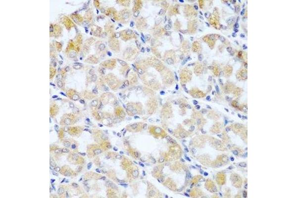 ANKRD52 antibody  (AA 450-660)
