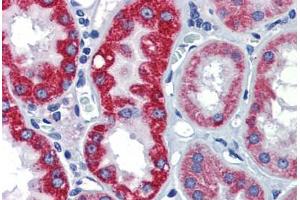 Immunohistochemistry (Paraffin-embedded Sections) (IHC (p)) image for anti-Early Growth Response 2 (EGR2) (AA 397-446) antibody (ABIN6741623)