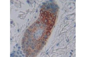 IHC-P analysis of Kidney tissue, with DAB staining. (Keratin 25 antibody  (AA 1-446))