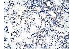 Nucleolin antibody was used for immunohistochemistry at a concentration of 4-8 ug/ml to stain Epithelial cells of renal tubule (arrows) in Human Kidney.