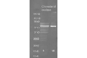 Goat anti Cholesterol oxidase antibody  was used to detect purified cholesterol oxidase under reducing (R) and non-reducing (NR) conditions. (Cholesterol Oxidase antibody  (HRP))