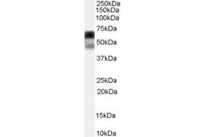 Western Blotting (WB) image for anti-EPH Receptor A3 (EPHA3) (N-Term) antibody (ABIN2787768) (EPH Receptor A3 antibody  (N-Term))