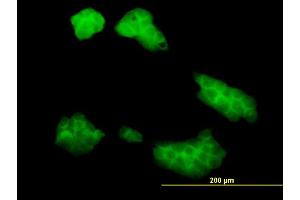 Immunofluorescence of monoclonal antibody to UBE2Q2 on A-431 cell. (UBE2Q2 antibody  (AA 1-110))