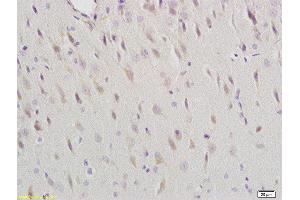 Formalin-fixed and paraffin embedded rat brain labeled with Anti-Dopamine Receptor D1 Polyclonal Antibody, Unconjugated  at 1:200 followed by conjugation to the secondary antibody and DAB staining (Dopamine Receptor d1 antibody  (AA 11-100))