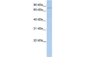 WB Suggested Anti-PYGB Antibody Titration:  0. (PYGB antibody  (N-Term))