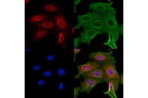 ABIN7094395 and ABIN7098442 staining Hela cells by IF/ICC. (NME5 antibody  (C-Term))