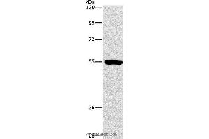 Western blot analysis of Mouse kidney tissue, using ANGPT2 Polyclonal Antibody at dilution of 1:800 (Angiopoietin 2 antibody)