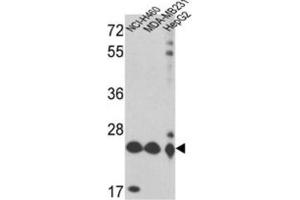 Western Blotting (WB) image for anti-Peroxiredoxin 3 (PRDX3) antibody (ABIN3001722) (Peroxiredoxin 3 antibody)