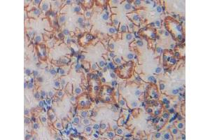 Immunohistochemistry (IHC) image for anti-Tumor Necrosis Factor Receptor Superfamily, Member 14 (TNFRSF14) (AA 45-262) antibody (ABIN1176210)