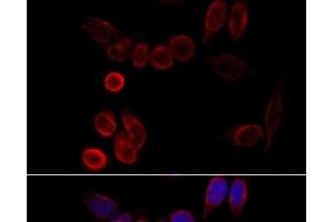 Immunofluorescence analysis of HeLa cells using CYP2A6 Polyclonal Antibody at dilution of 1:100 (40x lens). (CYP2A6 antibody)