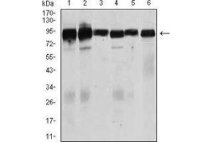 Western blot analysis using TGFBR3 mouse mAb against Jurkat (1), HeLa (2), MCF-7 (3), F9 (4), SK-N-SH (5), and NIH3T3 (6) cell lysate.