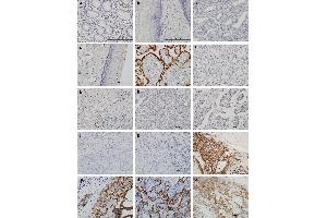 Immunostaining (ISt) image for anti-Hydroxy-delta-5-Steroid Dehydrogenase, 3 beta- and Steroid delta-Isomerase 1 (HSD3B1) (AA 1-373) antibody (ABIN561369)