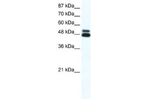 WB Suggested Anti-CHRNB2 Antibody Titration:  0. (CHRNB2 antibody  (N-Term))