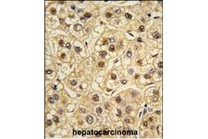 Formalin-fixed and paraffin-embedded human testis tissue reacted with YWHAZ Antibody (ABIN392783 and ABIN2842221) , which was peroxidase-conjugated to the secondary antibody, followed by DAB staining. (14-3-3 zeta antibody  (AA 211-239))