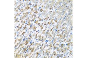 Immunohistochemistry of paraffin-embedded mouse stomach using CST1 antibody (ABIN5975714) at dilution of 1/100 (40x lens). (CST1 antibody)