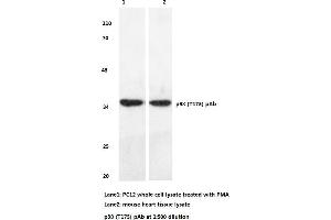 Western blot (WB) analyzes of p38 antibody (MAPK14 antibody)