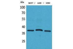 Western Blotting (WB) image for anti-CD79b Molecule, Immunoglobulin-Associated beta (CD79B) (Internal Region) antibody (ABIN3178286) (CD79b antibody  (Internal Region))