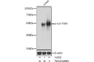 Western blot analysis of extracts of Jurkat cells, using Phospho-Lck-Y505 antibody (ABIN3020027, ABIN3020028, ABIN3020029 and ABIN6225502) at 1:1000 dilution. (LCK antibody  (pTyr505))
