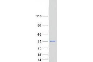 Validation with Western Blot (CCDC43 Protein (Transcript Variant 1) (Myc-DYKDDDDK Tag))