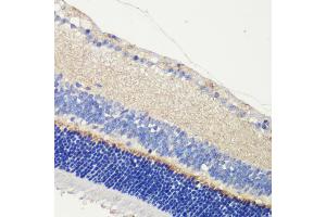 Immunohistochemistry of paraffin-embedded mouse retina using  antibody (ABIN6129704, ABIN6136903, ABIN6136905 and ABIN6216979) at dilution of 1:200 (40x lens). (Anoctamin 2 antibody  (AA 1-200))
