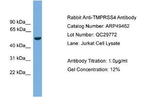 WB Suggested Anti-TMPRSS4  Antibody Titration: 0. (TMPRSS4 antibody  (N-Term))