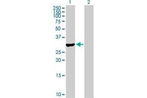 Western Blot analysis of RASD2 expression in transfected 293T cell line by RASD2 MaxPab polyclonal antibody. (RASD2 antibody  (AA 1-266))