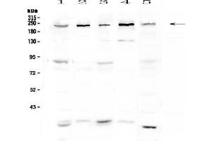 Western blot analysis of ASXL1 using anti-ASXL1 antibody . (ASXL1 antibody)