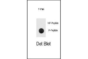 Dot blot analysis of anti-Phospho-TERT-p Antibody (ABIN389927 and ABIN2839747) on nitrocellulose membrane. (TERT antibody  (pSer1125))