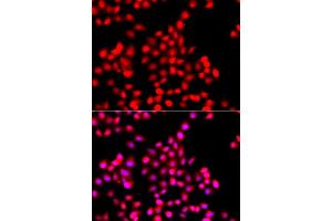 Immunofluorescence analysis of A549 cell using TTBK2 antibody. (TTBK2 antibody)