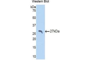 Detection of Recombinant SAP, Rat using Polyclonal Antibody to Serum Amyloid P Component (SAP) (APCS antibody  (AA 22-222))