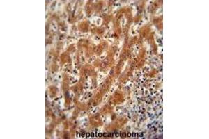 Immunohistochemistry (IHC) image for anti-Pyruvate Kinase (PK) antibody (ABIN2922768) (Pyruvate Kinase antibody)