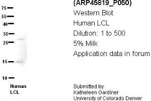 Image no. 2 for anti-Chromosome 21 Open Reading Frame 2 (C21orf2) (N-Term) antibody (ABIN2782373) (C21orf2 antibody  (N-Term))